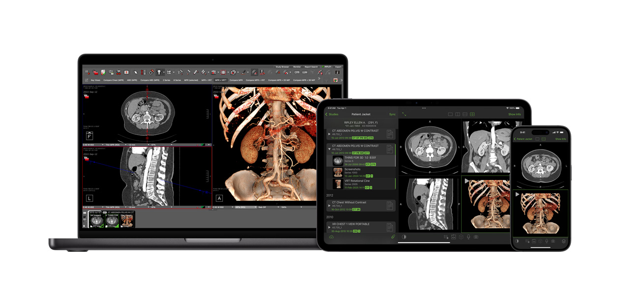 Interfaccia software dell’app Visage, che i team di radiologia usano per interpretare file diagnostici di grandi dimensioni.