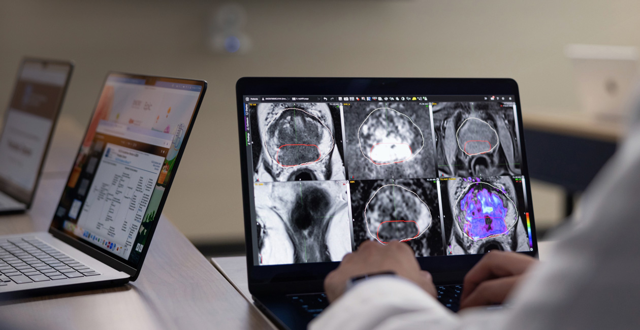 A MacBook Pro displaying radiology images.
